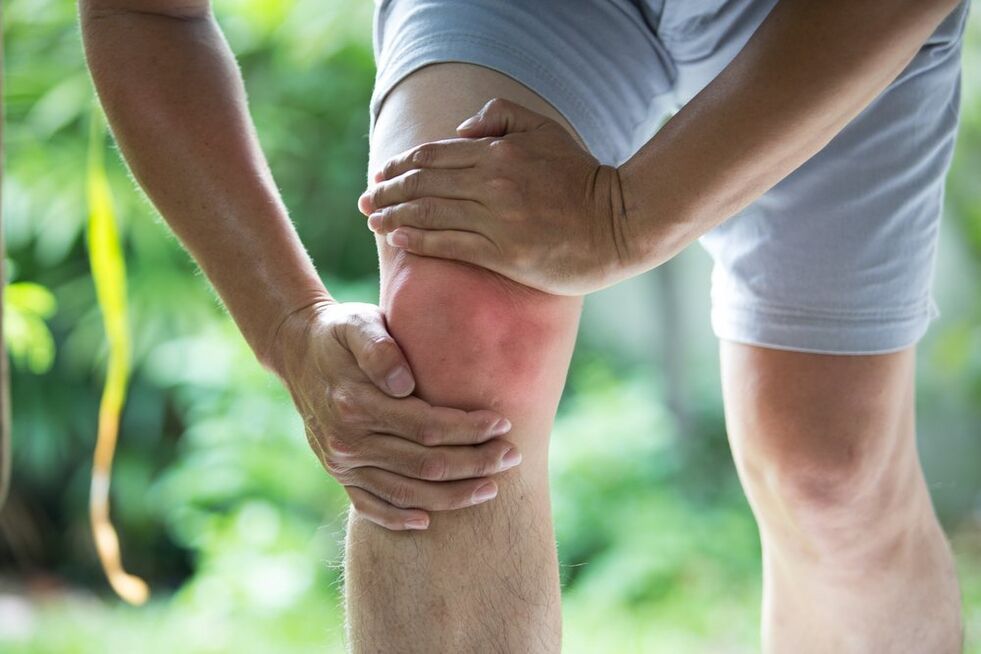 Locītavu sāpes ir visievērojamākā artrozes un artrīta izpausme. 