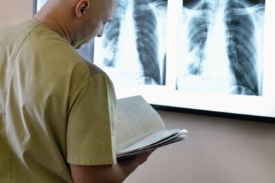 Mugurkaula krūšu kurvja rentgenogrāfija osteohondrozes diagnostikai